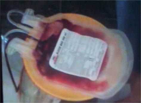 Blood Bank